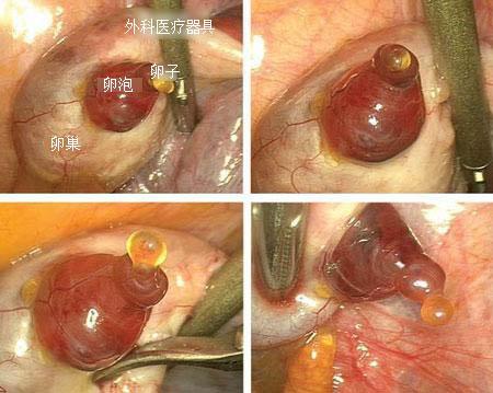 女性排卵过程